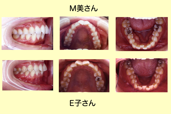 患者OGインタビュー