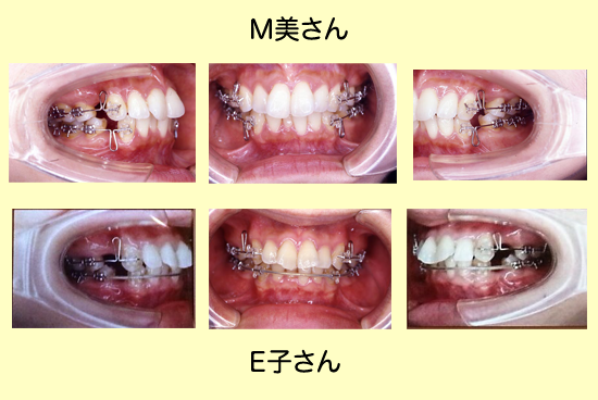 患者OGインタビュー