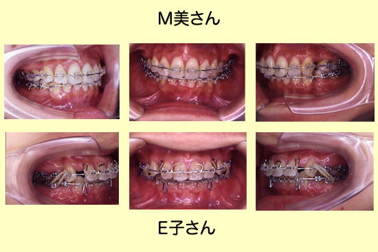 患者OGインタビュー