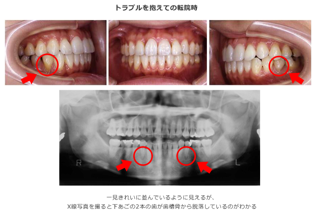 トラブルを抱えての転院時