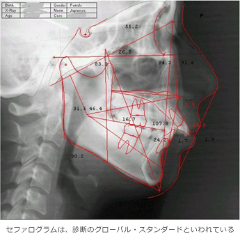 頭部Ｘ線規格写真（セファログラム）検査
