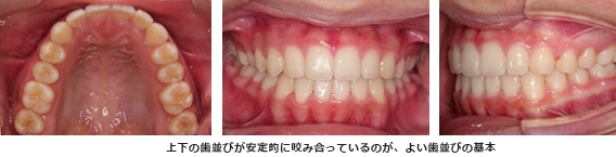上下の歯並びが安定的に咬み合っているのが、よい歯並びの基本