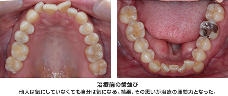 他人は気にしていなくても自分は気になる。結果、その思いが治療の原動力となった。