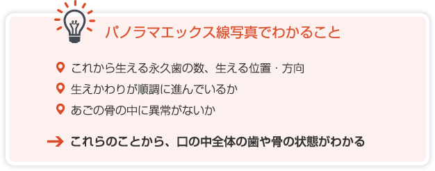 パノラマエックス線写真