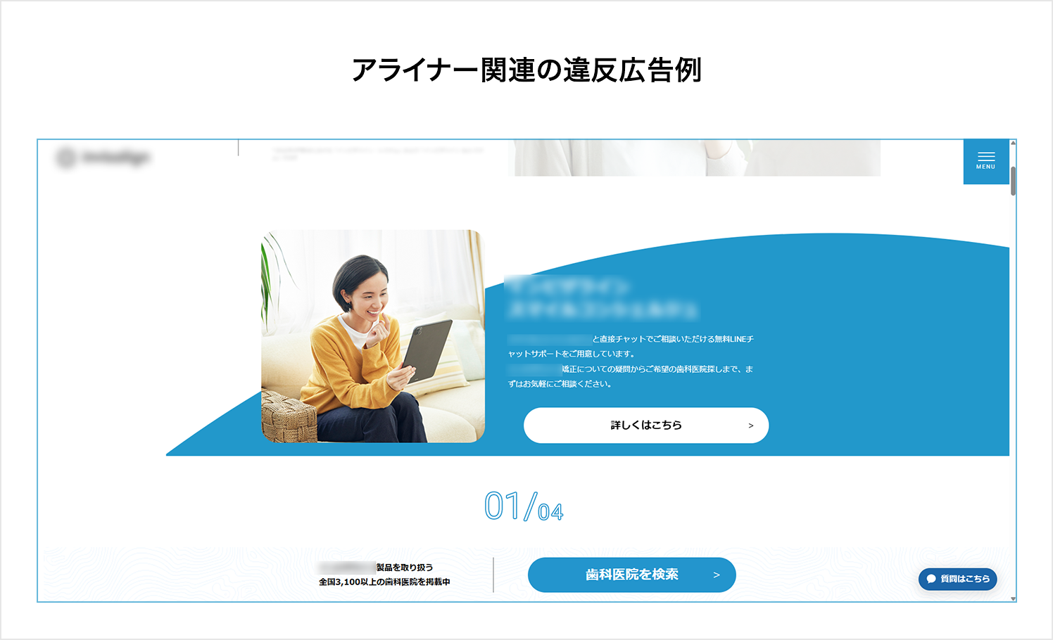 アライナー関連の違反広告例