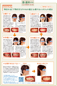 歯と歯並びのニューズレターVol.13.裏面