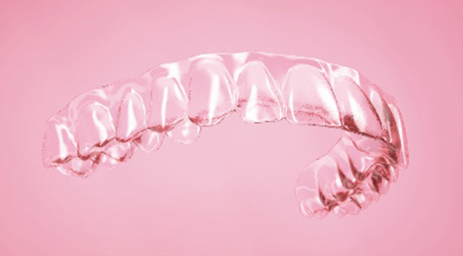 カスタムメイドのマウスピース型矯正装置（アライナー）。上下の歯に、この透明の装置を装着する