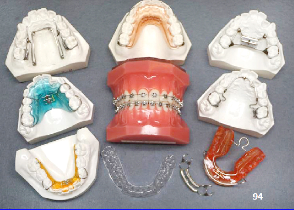 矯正歯科では、さまざまな装置を症例に応じて使い分ける