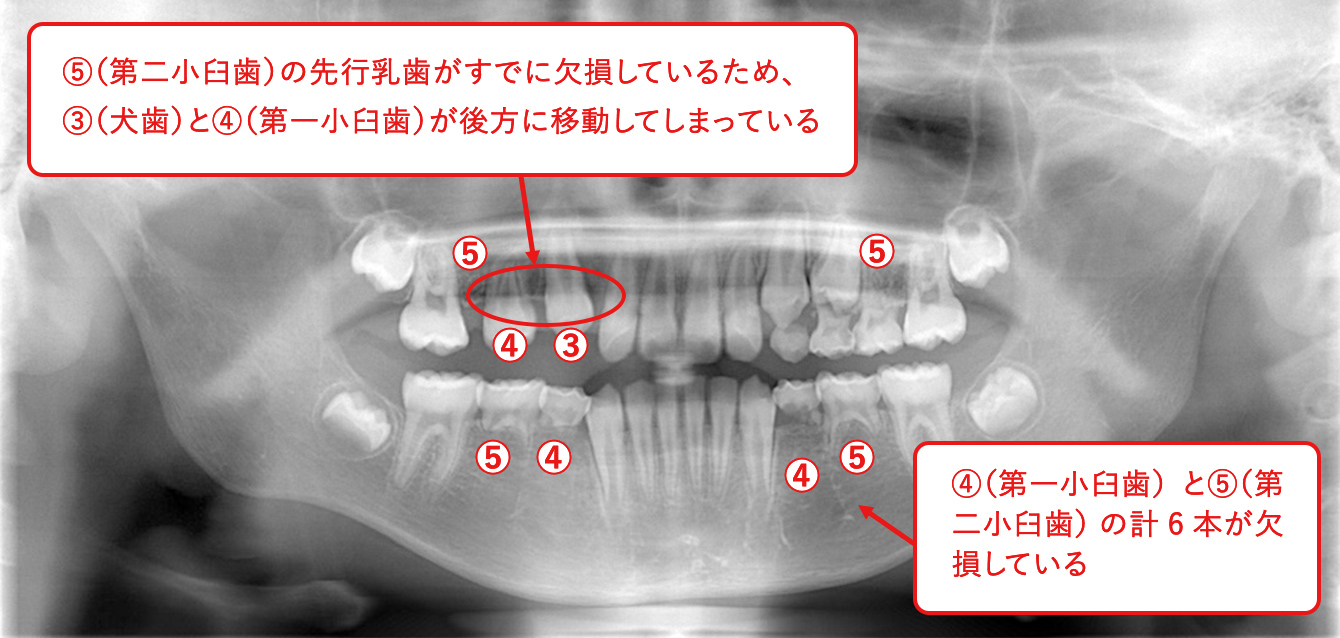 症例2