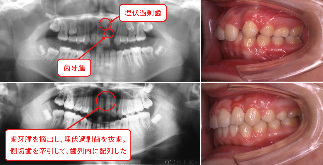 症例3