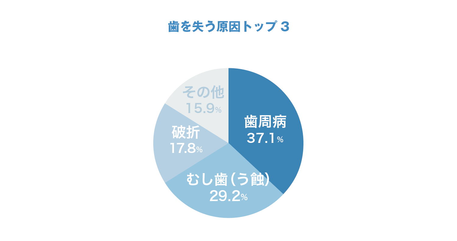 歯を失う原因トップ3