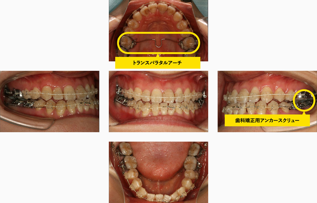 治療中（22歳）